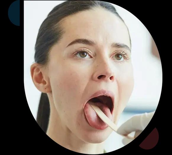 HowTreatedOralThrush