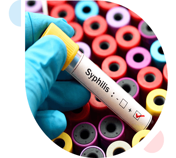 HowTreatedSyphlis