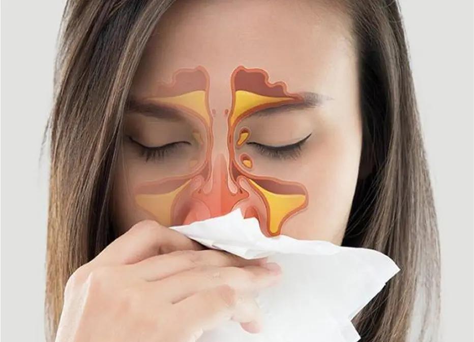 WhatSinusInfection