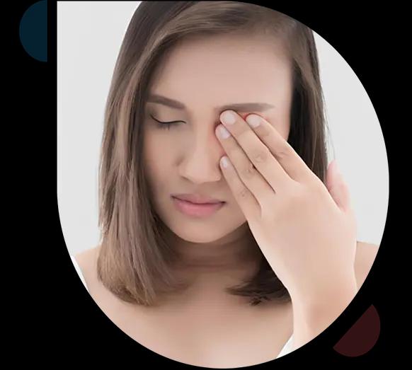 Stye-treated