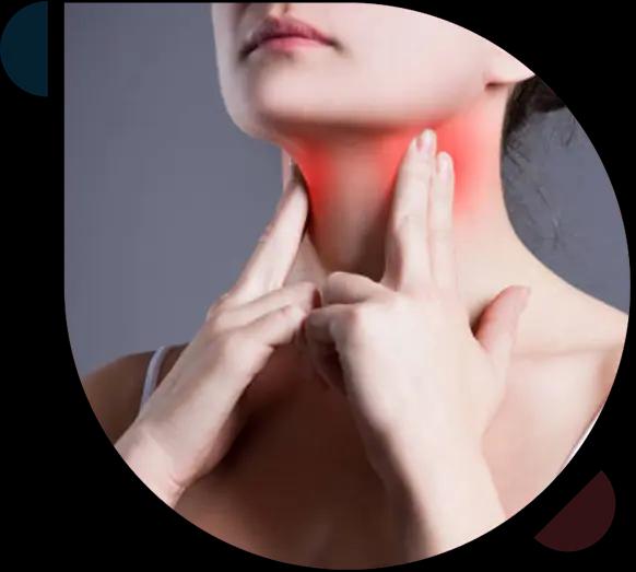 SideEffectStrepThroat